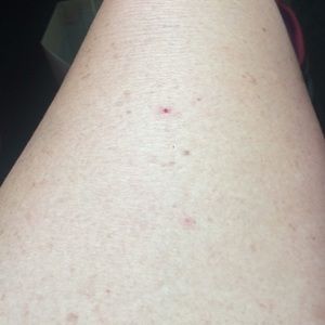 Meet your Posher, Lacy